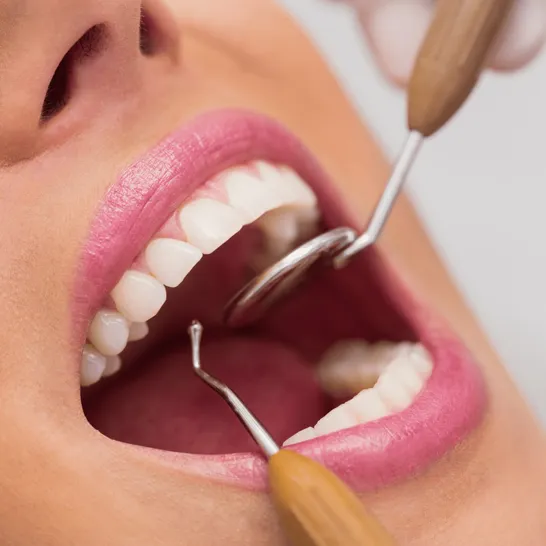 Dental Clinic In Saibaba Colony